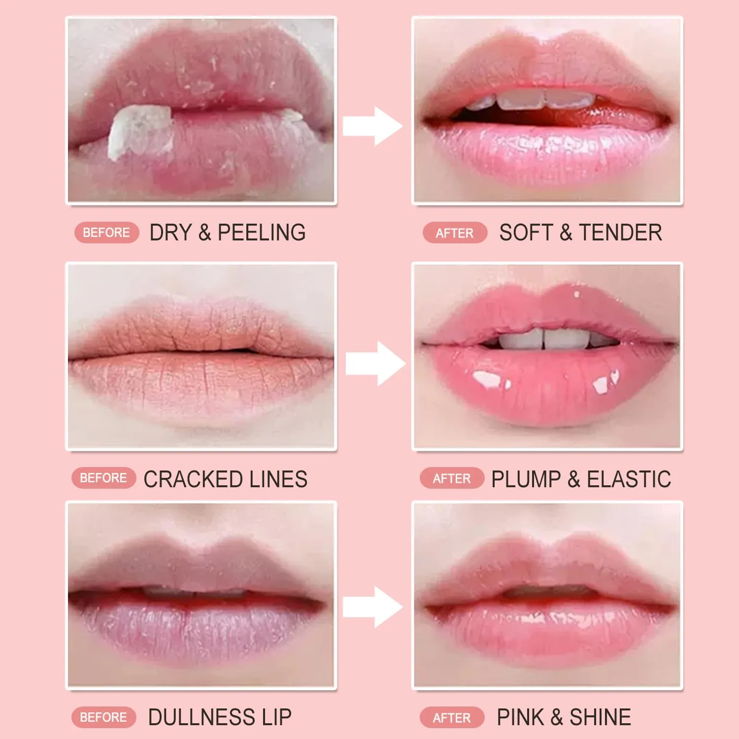 8 PCS Bee Lip Balm Honey Pot, Propolis Moisturizing Lip Balm Sleeping Lip Mask Hydrating Prevention Dry & Cracked Lip Scrubs Exfoliator Lip Care, Lip Mask Overnight Reduces Lip Lines