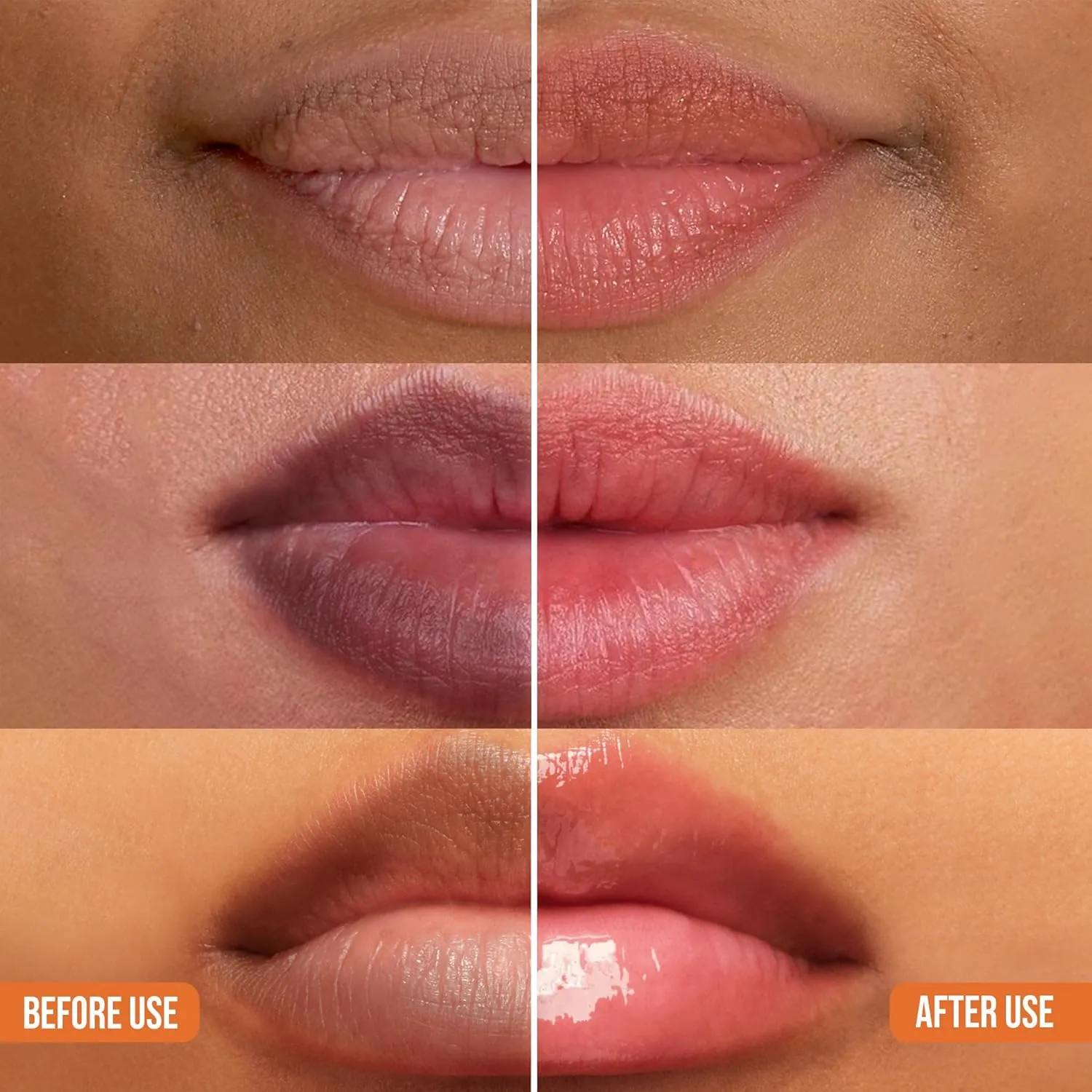 ABERA Dark Lips Corrector Cream, Lip Balm For Lightening & Brightening Dark Lips For Men & Women, Moisturizing Lip Plumper with Shea Butter, Lip Scrub, Fordyce Spot Remover (2 BOXES   GIFT)