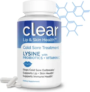 Cold Sore Treatment for Lips - Lysine Supercharged with Acidophilus Probiotic & Lactobacillus Rhamnosus   Vitamin C for Lip and Skin Health - Immune Support for Effective Prevention and Clear Skin