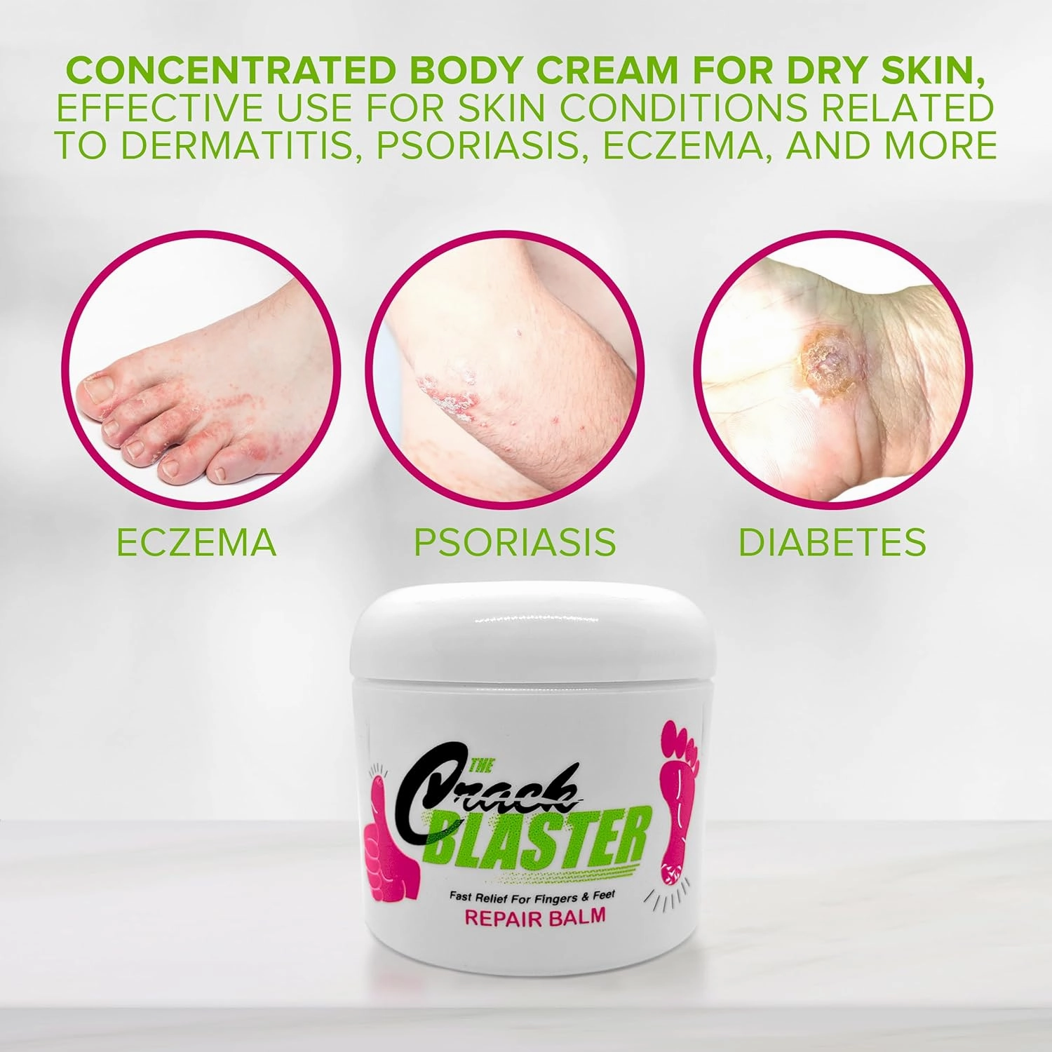 Crack Blaster Repair Balm - Lanolin Based Thick Moisturizing Balm for Dry Skin, Heel Pain, Plantar Fasciitis, Athletes Foot - 4 OZ Original Formula!