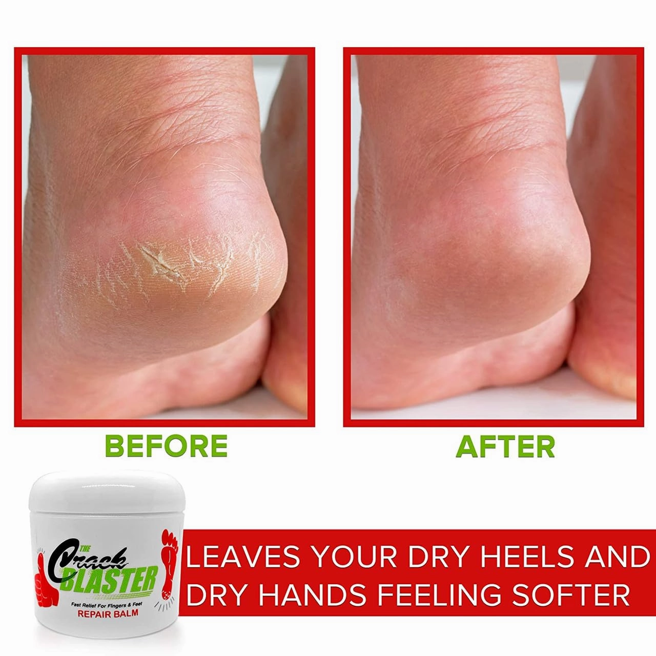 Crack Blaster Repair Balm - Lanolin Based Thick Moisturizing Balm for Dry Skin, Heel Pain, Plantar Fasciitis, Athletes Foot - 4 OZ Original Formula!