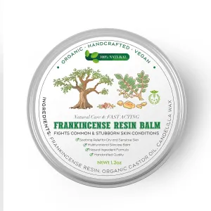 Frankincense Balm | Deep Hydration & Tension Relief Balm for Dry Skin & Feet | Plant-Based Moisturizer with Long-Lasting Comfort | 1.2 oz