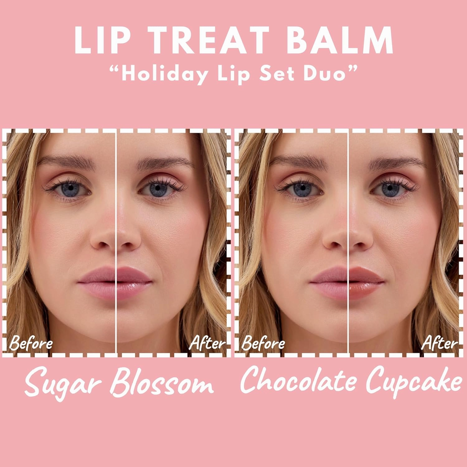 Lip Treat Balm - Hydrating & Nourishing Lip Balm with Avocado, Olive, and Coconut Oils - Softening Lip Moisturizer & Protection for Very Dry Lips - 1x Sugar Blossom & 1x Chocolate, 0.7oz