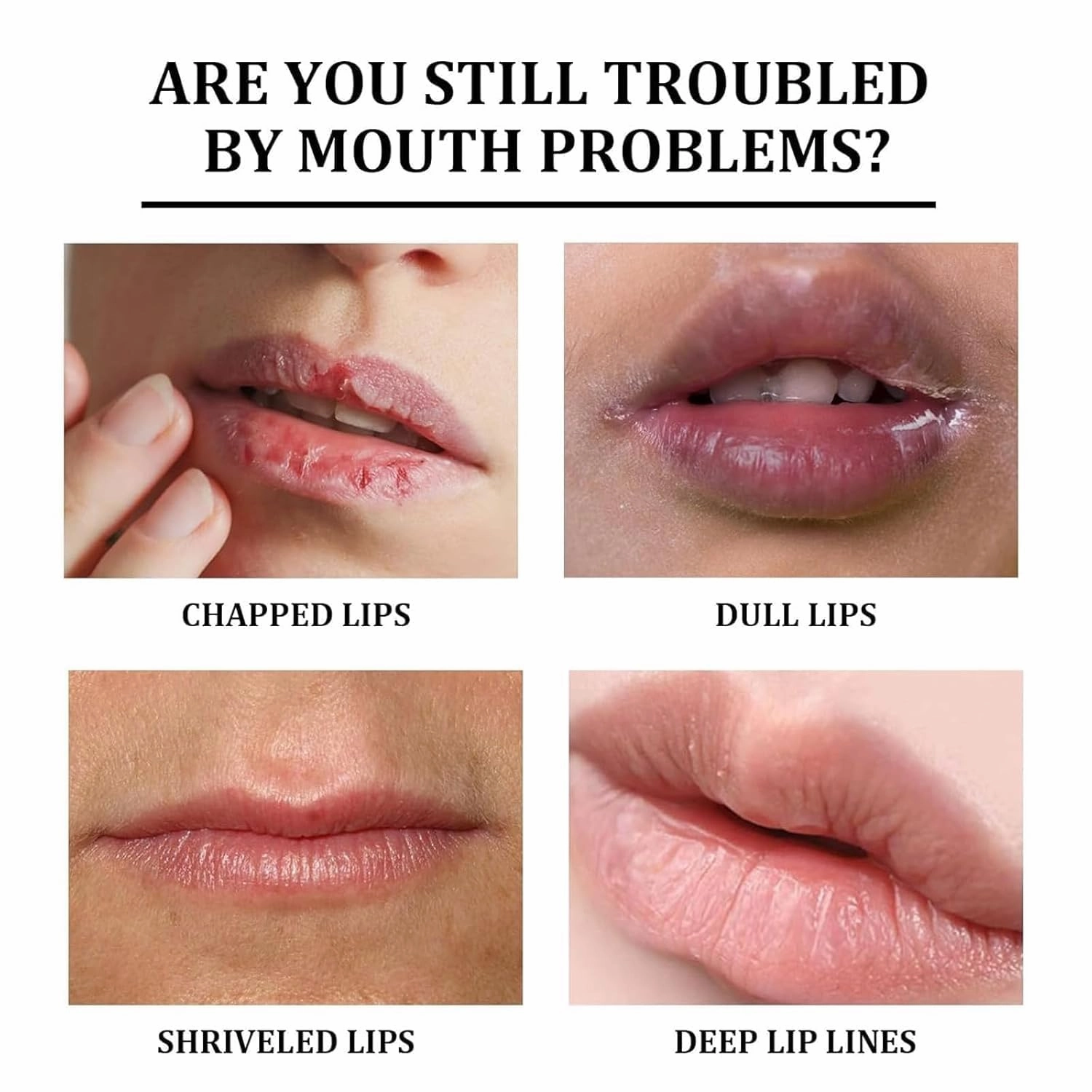 Mavellas Dark Lips Cream, MavellaDark lips Cream, Lips Balm For Dark Lip Moisturizer Nourishing Essence For Women & Men (mix)