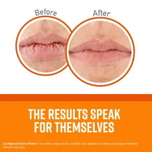 O'Keeffe's Unscented Lip Repair Lip Balm for Dry, Cracked Lips, Stick, (Pack of 2)