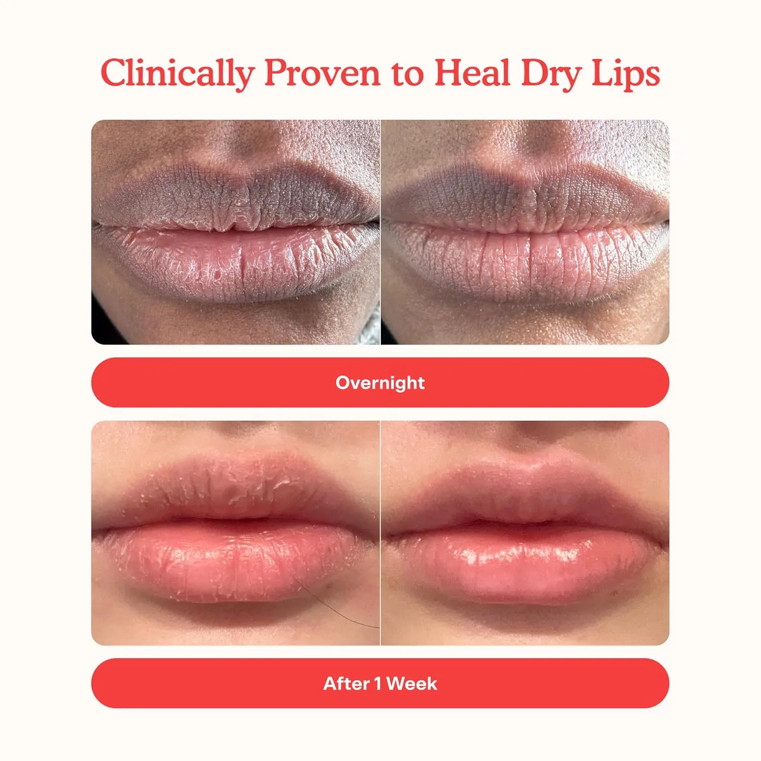 Tower 28 LipSoftie Hydrating Tinted Lip Treatment Balm, Moisturizing Lip Mask for Chapped Lips - Watermelon Kiwi Flavor, Sheer Baby Pink Gloss